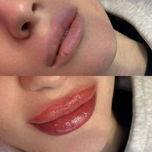 Lip blush before and after with semi-permanent pigment